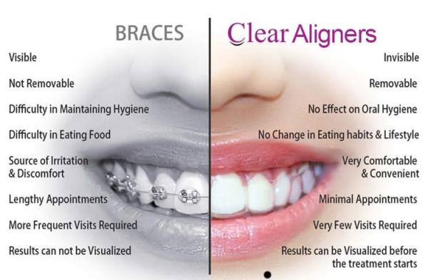 Comparison b/w METAL braces and Invisible braces